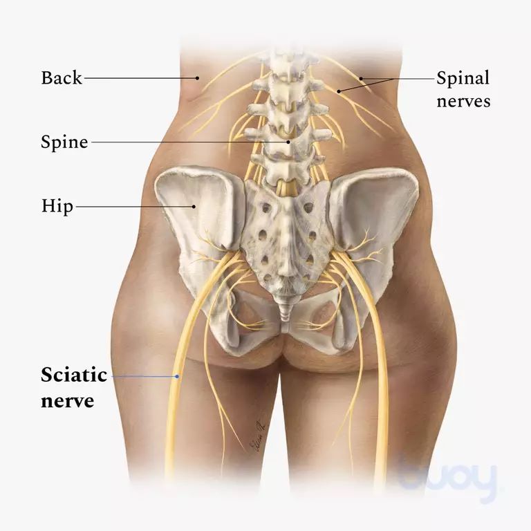 sciatic nerve pain
